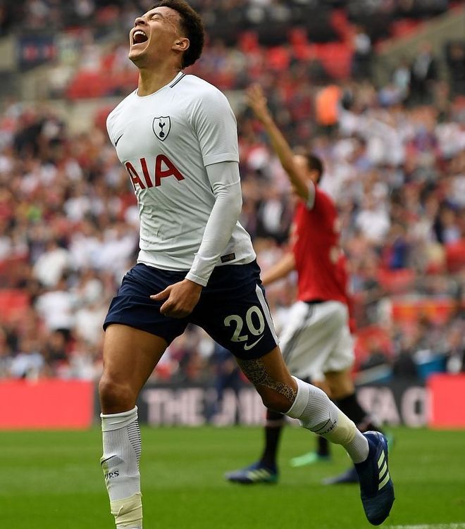 雄鹿堡惊险击败科隆,稳居积分榜前列,气势如虹 雄鹿堡惊险击败科隆,稳居积分榜前列,气势如虹